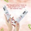 VCare Red Sandal Face Wash for Skin Whitening for Oily Skin | Reduce Acne and Pimples, Women and Men | Facial Cleanser | Skincare Face Cream, Remove Dark Circle 100 ml - Image 2