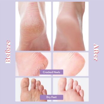 TOI:L Extra Silky Foot Mask Glove 5 Pairs, Premium Foot Care Treatment, Intensive Moisturizing, Nourishing, Repairing for the dry & rough damaged foot (Guerande salt+Sweet almond oil)