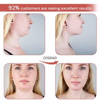 COSDAD Reusable Double Chin Reducer Chin Strap - V Line Lifting Mask for Women, with Innovative Lifting Technology, Breathable and Comfortable, One Fits All