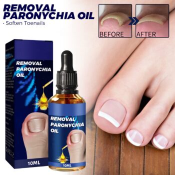 6PCs German Toenailcare Removal Paronychia Oil, Ingrown Toenail Nail Repair, German Toenailplus Anti Paronychia Relief Oil Nail Renewal Liquid for Damaged & Discoloration Nail