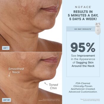 NuFACE TRINITY+ Microcurrent Facial Device, Wrinkle Reducer + Effective Lip & Eye Attachment - FDA Cleared Face Toning Device for Targeted Treatment + Microcurrent Gel Activator, Silk Crème & Brush