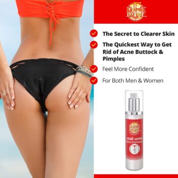 Anti-Acne Buttocks & Thigh Treatment- Clears Away Acne, Pimples, and Ingrown Hairs for the Buttocks and Thigh Area. Prevents Future Breakouts. 6.9 OZ