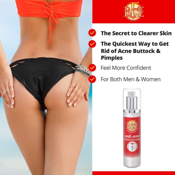 Anti-Acne Buttocks & Thigh Treatment- Clears Away Acne, Pimples, and Ingrown Hairs for the Buttocks and Thigh Area. Prevents Future Breakouts. 6.9 OZ